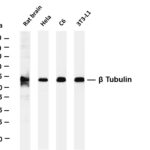 β Tubulin Rabbit Monoclonal Antibody