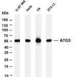 ATG5 Rabbit Monoclonal Antibody