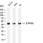 Beta Actin Rabbit Monoclonal Antibody