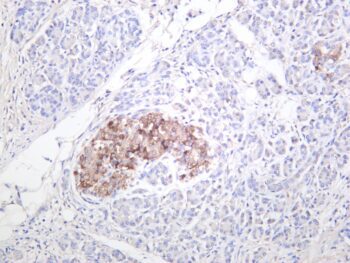 PTEN Rabbit Monoclonal Antibody - Image 2