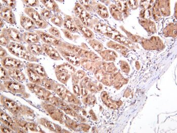 IRF3 Rabbit Monoclonal Antibody - Image 2