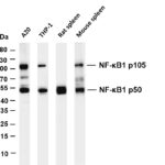 NF-κB1 p105/p50 Rabbit Monoclonal Antibody