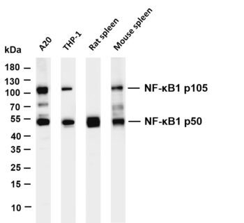 NF-κB1 p105/p50 Rabbit Monoclonal Antibody