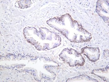 NF-κB1 p105/p50 Rabbit Monoclonal Antibody - Image 2