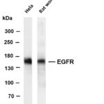 EGFR Rabbit Monoclonal Antibody