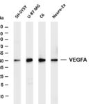 VEGFA Rabbit Monoclonal Antibody