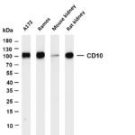 CD10 Rabbit Monoclonal Antibody