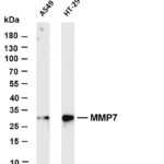 MMP7 Rabbit Monoclonal Antibody