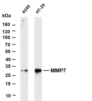 MMP7 Rabbit Monoclonal Antibody