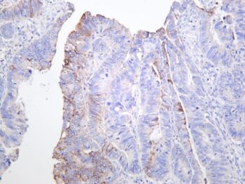 MMP7 Rabbit Monoclonal Antibody - Image 2