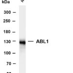 ABL1 Rabbit Monoclonal Antibody