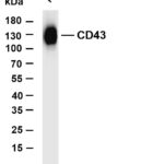 CD43 Rabbit Monoclonal Antibody