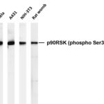 p90RSK (Phospho-Ser380) Rabbit Monoclonal Antibody