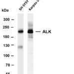 ALK Rabbit Monoclonal Antibody