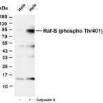 Raf-B (Phospho-Thr401) Rabbit Monoclonal Antibody