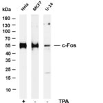 c-Fos Rabbit Monoclonal Antibody