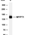 MYPT1 Rabbit Monoclonal Antibody