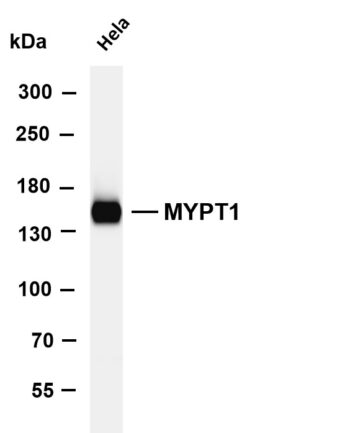 MYPT1 Rabbit Monoclonal Antibody
