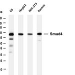 Smad4 Rabbit Monoclonal Antibody