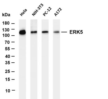 ERK5 Rabbit Monoclonal Antibody