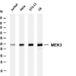 MEK3 Rabbit Monoclonal Antibody
