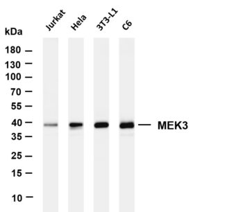 MEK3 Rabbit Monoclonal Antibody