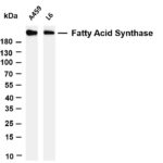 Fatty Acid Synthase Rabbit Monoclonal Antibody