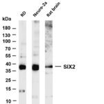 SIX2 Rabbit Monoclonal Antibody