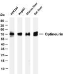 Optineurin Rabbit Monoclonal Antibody