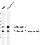 Cathepsin D Rabbit Monoclonal Antibody
