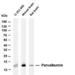 Parvalbumin Rabbit Monoclonal Antibody