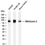 Mitofusin-2 Rabbit Monoclonal Antibody
