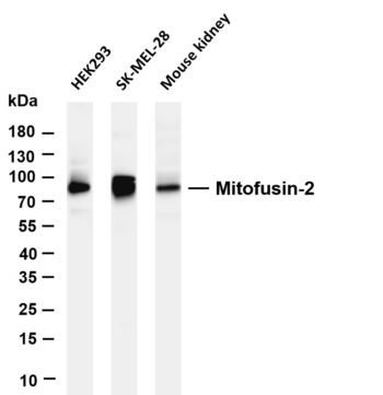 Mitofusin-2 Rabbit Monoclonal Antibody