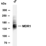 MDR1 Rabbit Monoclonal Antibody