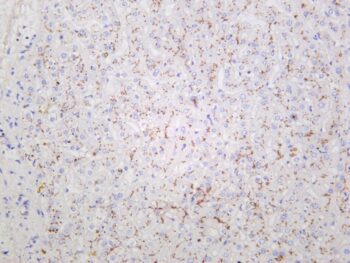 MDR1 Rabbit Monoclonal Antibody - Image 2