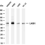 LKB1 Rabbit Monoclonal Antibody