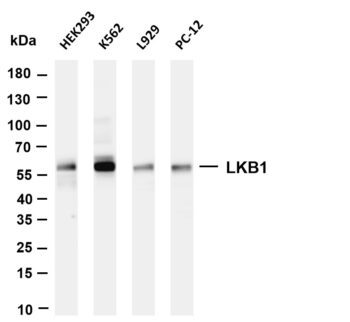 LKB1 Rabbit Monoclonal Antibody