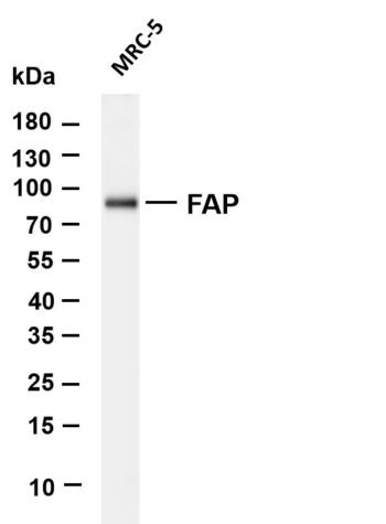 FAP Rabbit Monoclonal Antibody