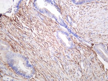 FAP Rabbit Monoclonal Antibody - Image 2