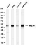 MEK4 Rabbit Monoclonal Antibody