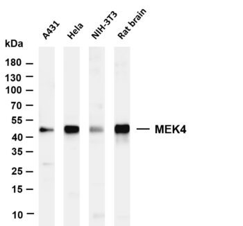 MEK4 Rabbit Monoclonal Antibody