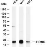 HRAS Rabbit Monoclonal Antibody