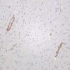 IRE1α Rabbit Monoclonal Antibody - Image 2
