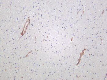 IRE1α Rabbit Monoclonal Antibody - Image 2