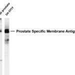 Prostate Specific Membrane Antigen Rabbit Monoclonal Antibody