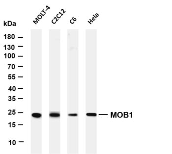 MOB1 Rabbit Monoclonal Antibody