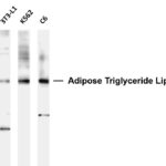 ATGL Rabbit Monoclonal Antibody