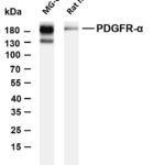 PDGFR-α Rabbit Monoclonal Antibody