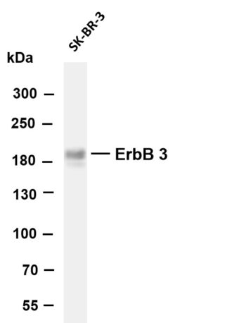 ErbB-3 Rabbit Monoclonal Antibody - Image 2