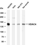 HDAC4 Rabbit Monoclonal Antibody